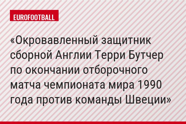 Окровавленный защитник сборной Англии Терри Бутчер по окончании отборочного матча чемпионата мира 1990 года против команды Швеции